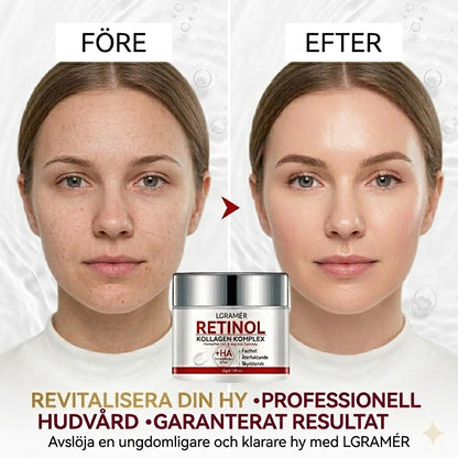 Uppstramande Retinolkräm ✨